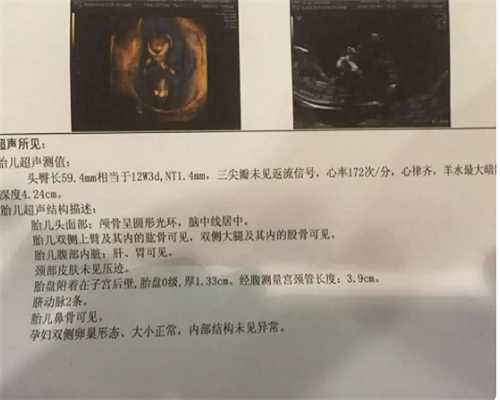 广州包成功助孕生女孩多少钱|广州供卵第三代试管婴儿医院排名？